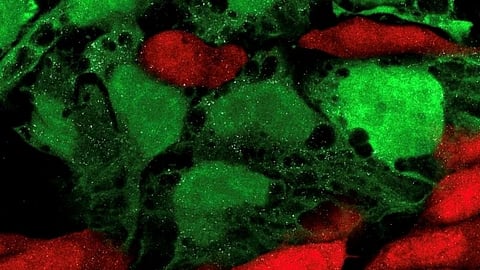An image of green and red cell.