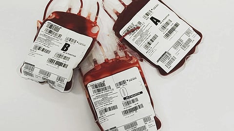 An image of three blood bags with labels, arranged together.