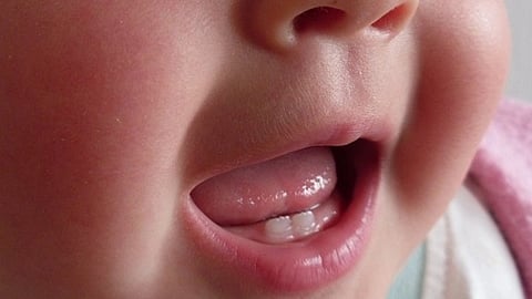 Image showing close up of a smiling baby with erupting lower teeth