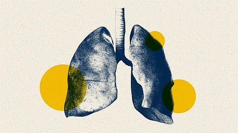 An image of illustration of human lungs in blue and white, with three yellow circles overlaid.
