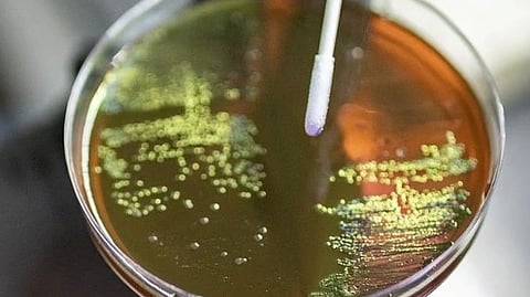 An image of bacteria.