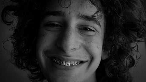 An image of a boy with braces.