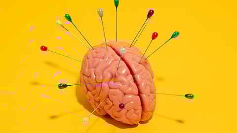 A model brain with multicolored pins inserted, set against a vibrant yellow background.