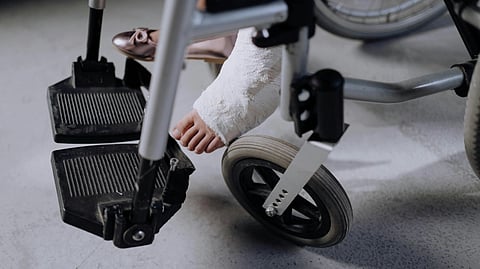 Person with an injured leg seated in a wheelchair, leg supported and bandaged over the foot rest.