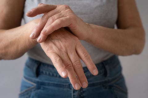 A complete guide to treating rheumatoid arthritis, covering medications, biologics, exercise, lifestyle changes, and specialty pharmacy support.
