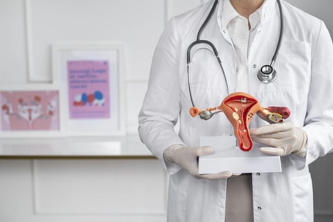 A doctor holding a plastic model of a female reproductive system. 