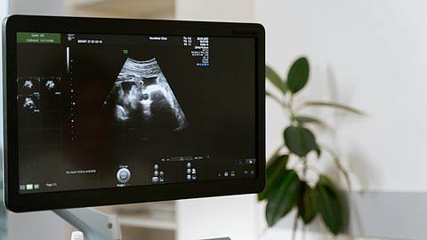 Ultrasound machine and visuals of fetus on screen.