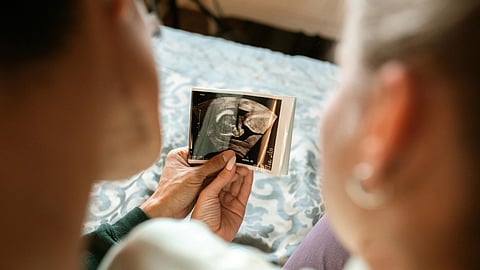 2 people holding a sonogram of baby in stomach.