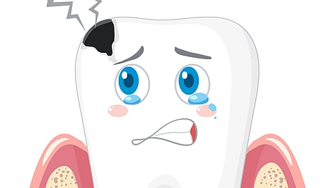 A graphical representation of decayed tooth. 