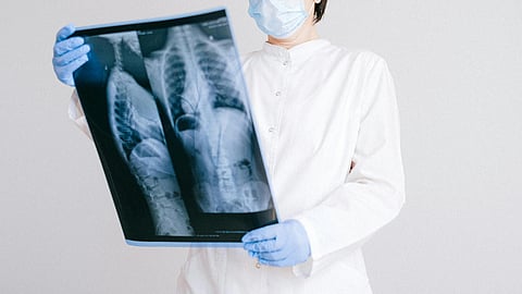 A doctor reading chest scans.