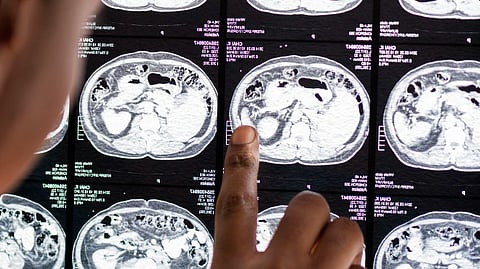 Doctor reading brain mri x-ray result