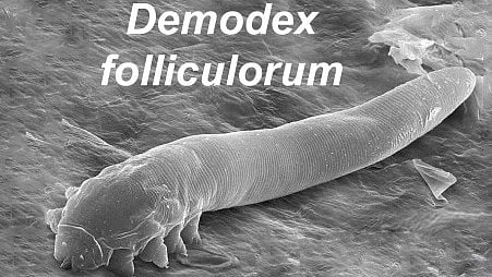 Microscopic image of Demodex folliculorum mite on textured surface.