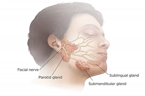 A diagram showing different salivary glands on a man's face and facial nerve supply. 