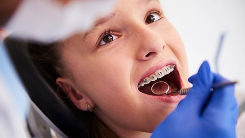 Young patient with braces during a dental check-up, mouth open.