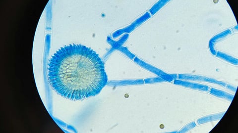 A microscopic view shows blue fungal hyphae and a round spore structure against a light background.