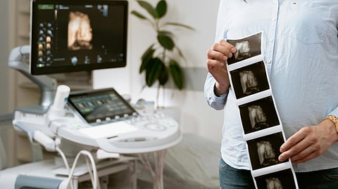An ultrasound scan and machine.