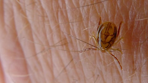 A close-up of a bug crawling on a person's arm.