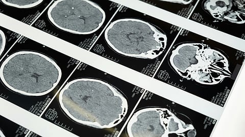 Numerous MRI images arranged on a table.