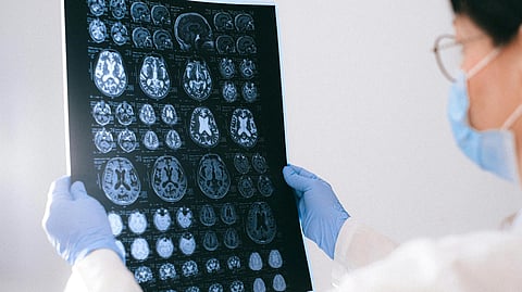 Woman in lab coat holding large MRI scan image.