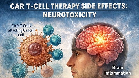 An image showing neurotoxicity symptoms as side effects of CAR T-Cell therapy