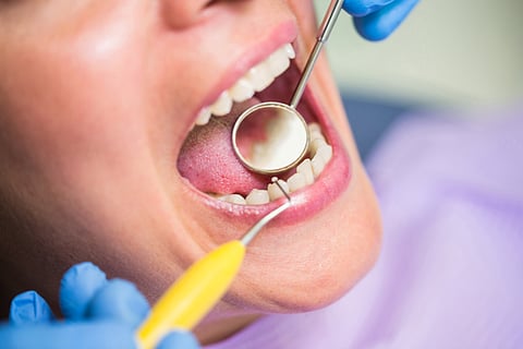 A dental examination going on in an open mouth. 