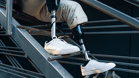 A person wearing a prosthetic leg and white shoes stands.
