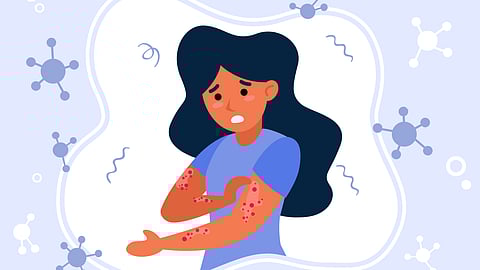A person with dark hair in a blue shirt scratches a rash on their arm, with virus shapes floating around to show illness.