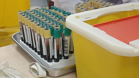 A tray holding numerous blood sample tubes with yellow and green caps sits on a table.