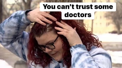 A red head woman showing her scalp.