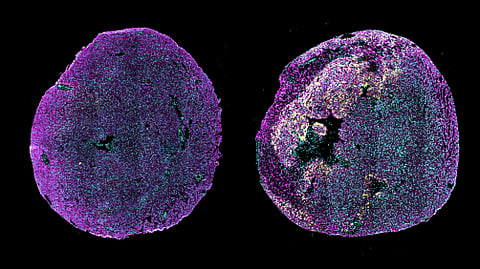 Immunofluorescence image of transverse heart sections from a healthy neonatal mouse 