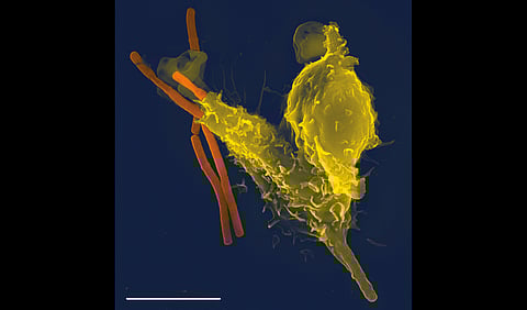 Neutrophil engulfing anthrax bacteria, taken with a Leo 1550 scanning electron microscope. Scale bar is 5 micrometers.