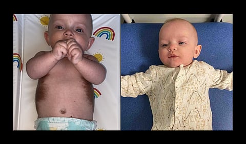 Macey-Mai lying on , few lesions visible.