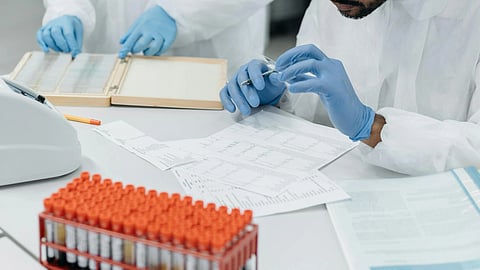 Two scientists in lab coats and goggles work diligently in a bright lab, with a blood sample beside them.