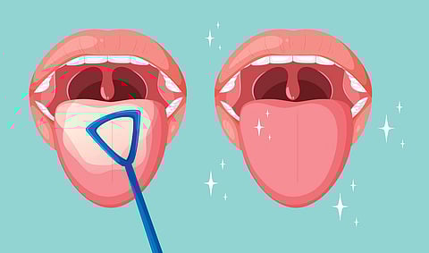 Oral hygiene and tongue cleaning illustration.