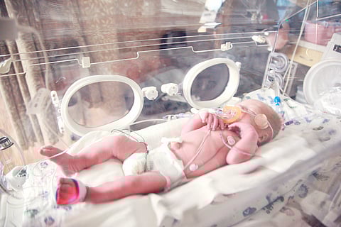 A 34-week premature baby in an incubator with a pacifier, receiving oxygen support for respiratory assistance.