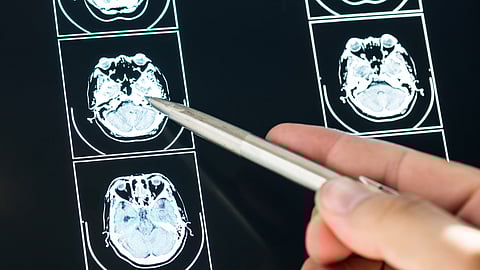 Closeup of brain mri scan result