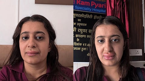 Passenger showing her allergic reaction