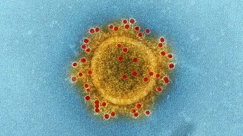 Colorized micrograph of a spherical virus particle, gold with red spikes, on a blue background.