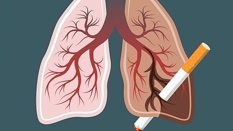 Illustration of healthy and diseased lungs contrasting effects of smoking. A cigarette pierces the diseased lung. 