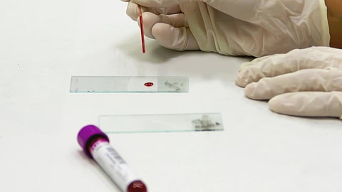 A gloved hand prepares a blood smear on a glass slide using a pipette, with a blood sample tube nearby.