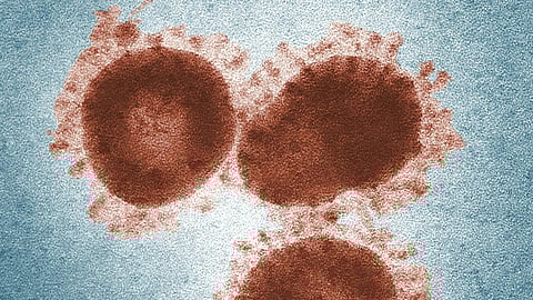 Close-up of four brown, spiky coronavirus particles against a blue background.