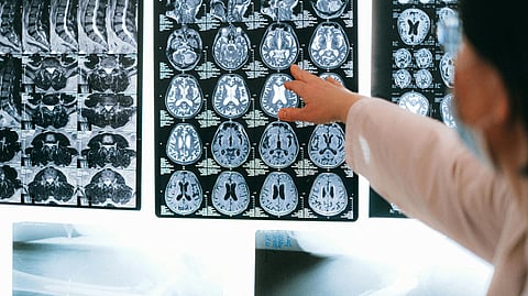 A doctor points at a brain MRI scan on a lightbox, highlighting detailed cross-sections. 
