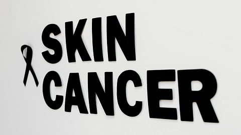 Text "Skin Cancer" in bold black letters on a white background with a small black ribbon symbol.