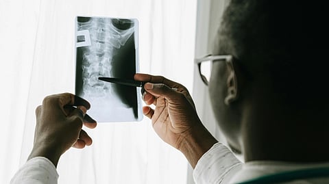 A doctor checking a spine xray.