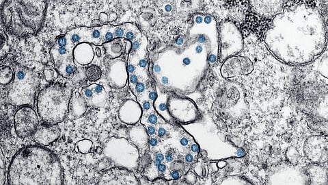 Microscopic view of viral particles inside a cell.
