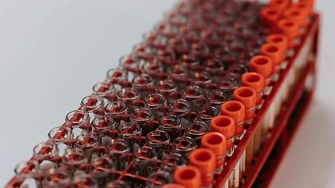 Blood test tubes.