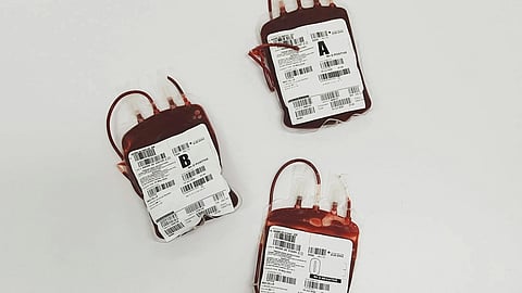 Three blood bags labeled A, B, and O are arranged on a white surface. 