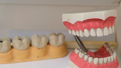 Dental models showing teeth and gums on a shelf.