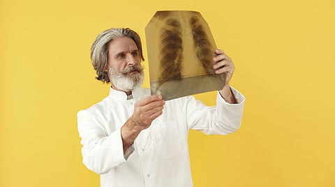 A doctor in a white coat examines a chest X-ray against a bright yellow background. 