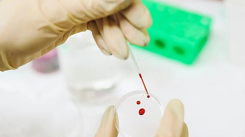 Gloved hands transfer blood drops into a petri dish in a lab.